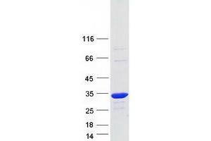 Validation with Western Blot