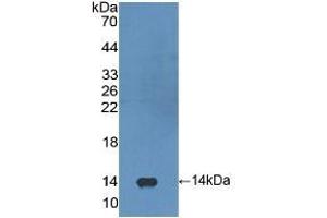 Detection of Recombinant FGF23, Human using Polyclonal Antibody to Fibroblast Growth Factor 23 (FGF23) (FGF23 抗体  (AA 79-160))