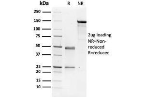 SDS-PAGE Analysis Purified NME1 / nm23-H1 Mouse Monoclonal Antibody (CPTC-NME1-2). (NME1 抗体)