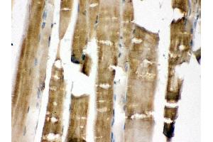 Anti- MEK3 Picoband antibody, IHC(P) IHC(P): Rat Skeletal Muscle Tissue (MAP2K3 抗体  (C-Term))