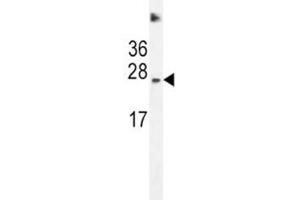 SDHD antibody western blot analysis in HeLa lysate (SDHD 抗体  (AA 13-42))