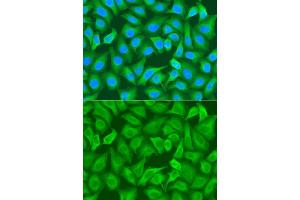 Immunofluorescence analysis of A549 cell using RRM1 antibody. (RRM1 抗体)