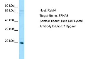 Western Blotting (WB) image for anti-Ephrin A5 (EFNA5) (N-Term) antibody (ABIN2790146) (Ephrin A5 抗体  (N-Term))