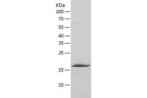 Western Blotting (WB) image for Procathepsin K (AA 19-215) protein (His tag) (ABIN7124566)