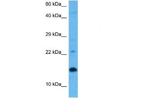 Host:  Rat  Target Name:  UBE2D1  Sample Tissue:  Rat Skeletal Muscle  Antibody Dilution:  1ug/ml
