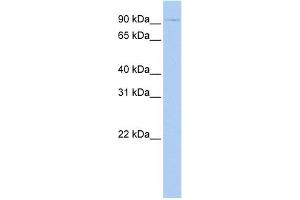 WB Suggested Anti-TSHR Antibody Titration:  0. (TSH receptor 抗体  (N-Term))