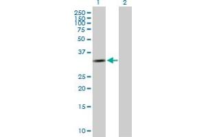 Western Blot analysis of CCND2 expression in transfected 293T cell line by CCND2 MaxPab polyclonal antibody. (Cyclin D2 抗体  (AA 1-289))