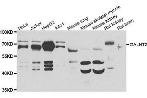 Western blot analysis of extracts of various cell lines, using GALNT2 antibody. (GALNT2 抗体)