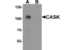 Western blot analysis of CASK in mouse brain tissue lysate with CASK antibody at 1 µg/mL in (A) the absence and (B) the presence of blocking peptide.