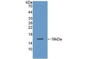 Detection of Recombinant SST, Rat using Polyclonal Antibody to Somatostatin (SST) (Somatostatin 抗体  (AA 27-116))