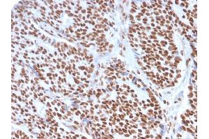 Immunohistochemistry (IHC) image for anti-Estrogen Receptor 1 (ESR1) (AA 129-312) antibody (ABIN6939346)