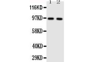 Anti-TLR4 antibody, Western blotting Lane 1: HELA Cell Lysate  Lane 2: SMMC Cell Lysate (TLR4 抗体  (N-Term))