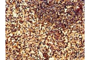 Immunohistochemistry of paraffin-embedded human spleen tissue using ABIN7169222 at dilution of 1:100 (WNK1 抗体  (AA 1-207))