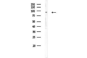 Western blot analysis of lysates from Rat liver, using GPAT-2 Antibody at 1/1000 dilution.