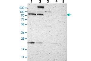 Western blot analysis of Lane 1: RT-4, Lane 2: U-251 MG, Lane 3: Human Plasma, Lane 4: Liver, Lane 5: Tonsil with TMF1 polyclonal antibody  at 1:250-1:500 dilution. (TMF1 抗体)