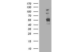 Image no. 1 for anti-Aldehyde Dehydrogenase 3 Family, Member A2 (ALDH3A2) antibody (ABIN1496595) (ALDH3A2 抗体)