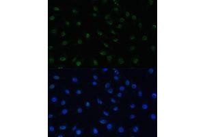 Immunofluorescence (IF) image for anti-Proline-, Glutamic Acid- and Leucine-Rich Protein 1 (PELP1) (AA 1021-1180) antibody (ABIN3023502)