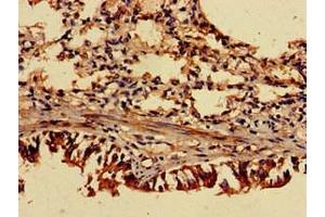 Immunohistochemistry of paraffin-embedded human lung tissue using ABIN7143158 at dilution of 1:100 (TRIP4 抗体  (AA 360-535))