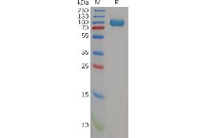 SDS-PAGE (SDS) image for Dipeptidyl-Peptidase 4 (DPP4) (AA 34-766) protein (His tag) (ABIN7092742)