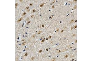 Immunohistochemistry of paraffin-embedded rat brain using LGALS3 antibody at dilution of 1:200 (x400 lens) (Galectin 3 抗体  (AA 1-250))