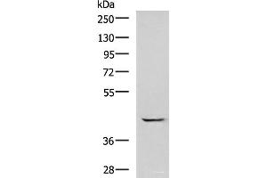 Western blot analysis of A549 cell lysate using GABPB1 Polyclonal Antibody at dilution of 1:1000 (GABPB1 抗体)