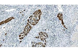 IHC analysis of Glycine decarboxylase/GLDC using anti-Glycine decarboxylase/GLDC antibody (ABIN7602073). (GLDC 抗体  (AA 574-1020))