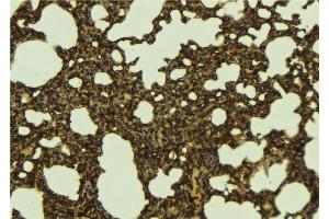 ABIN6276705 at 1/100 staining Mouse lung tissue by IHC-P. (RENT1/UPF1 抗体)