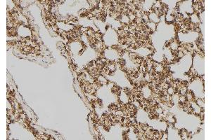 ABIN6275518 at 1/100 staining Rat lung tissue by IHC-P. (DVL2 抗体  (C-Term))