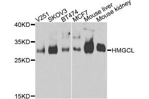Western blot analysis of extracts of various cells, using HMGCL antibody. (HMGCL 抗体)