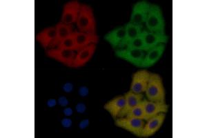 VSIG2 Mouse Monoclonal Antibody staining Hela cells by IF/ICC.