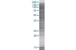 Western Blotting (WB) image for EPOR 293T Cell Transient Overexpression Lysate(Denatured) (ABIN1331729)