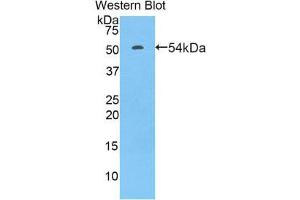Western Blotting (WB) image for anti-Fc Fragment of IgG, Low Affinity IIIa, Receptor (CD16a) (FCGR3A) (AA 5-241) antibody (ABIN1858832) (FCGR3A 抗体  (AA 5-241))