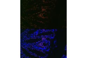 Immunofluorescence (IF) image for anti-Caudal Type Homeobox 2 (CDX2) antibody (ABIN7266152)