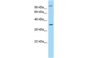 WB Suggested Anti-NPBWR2 Antibody Titration: 1. (NPBWR2 抗体  (N-Term))