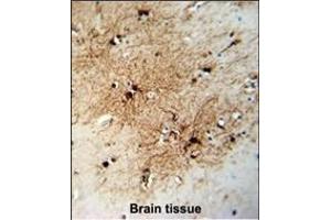 Immunohistochemistry (Paraffin-embedded Sections) (IHC (p)) image for anti-Fatty Acid Binding Protein 7, Brain (FABP7) (AA 104-132), (C-Term) antibody (ABIN651218)