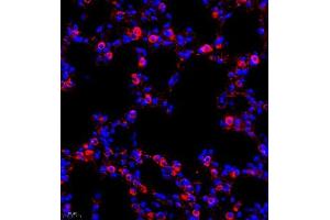 Immunofluorescence (IF) image for anti-Chloride Intracellular Channel 6 (CLIC6) antibody (ABIN7073478) (CLIC6 抗体)