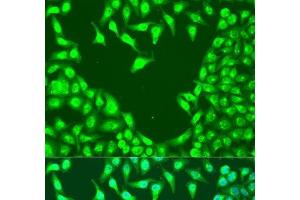 Immunofluorescence analysis of U2OS cells using MAP2K4 Polyclonal Antibody at dilution of 1:100. (MAP2K4 抗体)