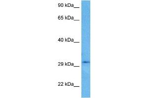 Host:  Rabbit  Target Name:  CBR3  Sample Tissue:  Human U937 Whole Cell lysates  Antibody Dilution:  1ug/ml (CBR3 抗体  (C-Term))