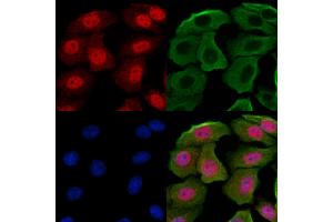 ABIN7094246 and ABIN7098293 staining Hela cells by IF/ICC. (GABPB1 抗体  (Internal Region))