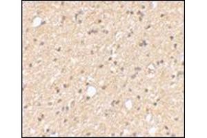 Immunohistochemical staining of human brain tissue using AP30499PU-N at 2. (LGI2 抗体  (Center))