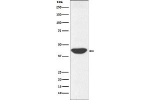 Western Blotting (WB) image for anti-Isocitrate Dehydrogenase 1 (NADP+), Soluble (IDH1) antibody (ABIN7607044)