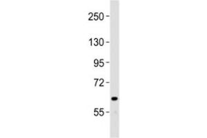 Western blot testing of NOTCH4 antibody at 1:2000 dilution + human liver lysate (NOTCH4 抗体  (C-Term))
