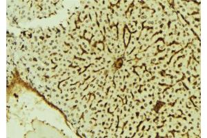 ABIN6279807 at 1/100 staining Mouse liver tissue by IHC-P. (SCML2 抗体  (Internal Region))