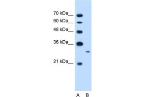 Western Blotting (WB) image for anti-MAP3K7 C-Terminal Like (MAP3K7CL) antibody (ABIN2462602) (MAP3K7CL 抗体)