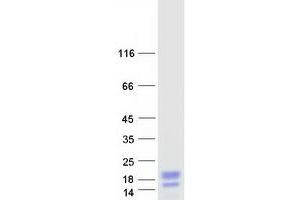 Western Blotting (WB) image for Secretoglobin, Family 2A, Member 2 (SCGB2A2) protein (Myc-DYKDDDDK Tag) (ABIN2731465)