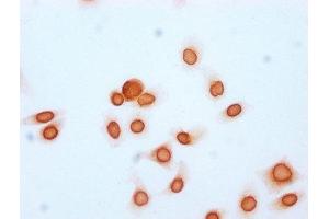 Immunocytochemistry analysis of ABIN7139170 diluted at 1:15 and staining in Hela cells (treated with 30mM sodium butyrate for 4h) performed on a Leica BondTM system. (Histone H2B 抗体  (acLys20))