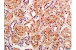 Formalin-fixed and paraffin embedded human kidney labeled with Anti-BBS5 Polyclonal Antibody, Unconjugated (ABIN1386114) at 1:200 followed by conjugation to the secondary antibody and DAB staining (BBS5 抗体  (AA 220-270))