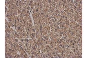 IHC-P Image Immunohistochemical analysis of paraffin-embedded U87 xenograft, using HSF2BP, antibody at 1:500 dilution. (HSF2BP 抗体)