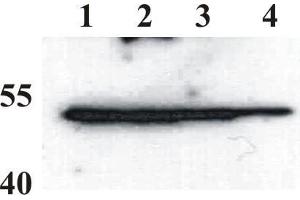 Western Blot testing of anti-BPV E2 monoclonal antibody (1E2). (Bovine Papilloma Virus 1 E2 (BPV-1 E2) (AA 208-218) 抗体)
