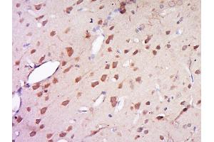 Paraformaldehyde-fixed, paraffin embedded rat brain, Antigen retrieval by boiling in sodium citrate buffer (pH6) for 15min, Block endogenous peroxidase by 3% hydrogen peroxide for 30 minutes, Blocking buffer (normal goat serum) at 37°C for 20min, Antibody incubation with Rabbit Anti-AMN1 Polyclonal Antibody, Unconjugated  at 1:500 overnight at 4°C, followed by a conjugated secondary for 90 minutes and DAB staining. (AMN1 抗体  (AA 1-100))